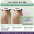 Sanfe Dark Spots|Acne Clearing Body Soap